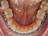 Progressive - Ali Orthodontics Dental