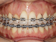 Progressive - Ali Orthodontics Dental