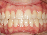 Progressive - Ali Orthodontics Dental