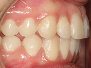 Progressive - Ali Orthodontics Dental