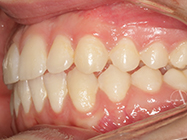 Progressive - Ali Orthodontics Dental