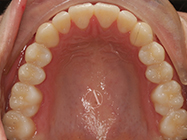 Progressive - Ali Orthodontics Dental