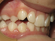 Progressive - Ali Orthodontics Dental