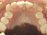 Progressive - Ali Orthodontics Dental