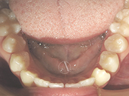 Progressive - Ali Orthodontics Dental