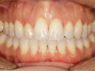 Progressive - Ali Orthodontics Dental