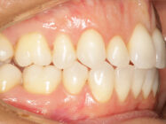 Progressive - Ali Orthodontics Dental