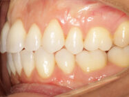 Progressive - Ali Orthodontics Dental