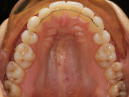 Progressive - Ali Orthodontics Dental