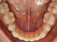 Progressive - Ali Orthodontics Dental