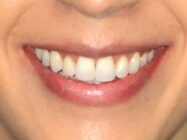 Progressive - Ali Orthodontics Dental