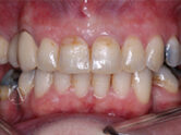 After - Ali Orthodontics Dental
