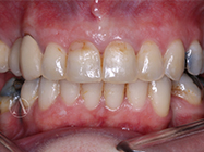 After - Ali Orthodontics Dental