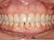 After - Ali Orthodontics Dental