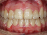 After - Ali Orthodontics Dental