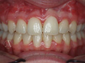 After - Ali Orthodontics Dental