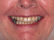 After - Ali Orthodontics Dental