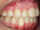 After - Ali Orthodontics Dental