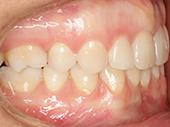 After - Ali Orthodontics Dental
