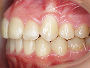 After - Ali Orthodontics Dental