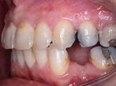 After - Ali Orthodontics Dental