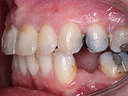 After - Ali Orthodontics Dental