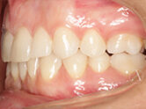 After - Ali Orthodontics Dental