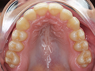 After - Ali Orthodontics Dental