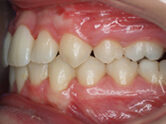 After - Ali Orthodontics Dental