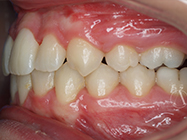 After - Ali Orthodontics Dental