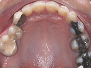 After - Ali Orthodontics Dental