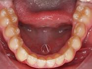 After - Ali Orthodontics Dental