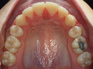 After - Ali Orthodontics Dental