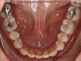 After - Ali Orthodontics Dental