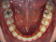 After - Ali Orthodontics Dental