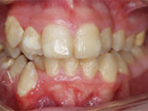 Before - Ali Orthodontics Dental