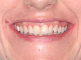 Before - Ali Orthodontics Dental