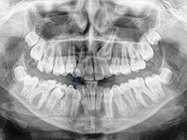 Before - Ali Orthodontics Dental