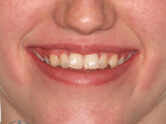 Before - Ali Orthodontics Dental