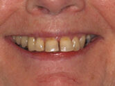 Before - Ali Orthodontics Dental
