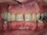 Before - Ali Orthodontics Dental