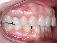 Before - Ali Orthodontics Dental