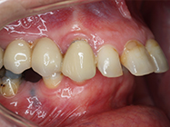 Before - Ali Orthodontics Dental