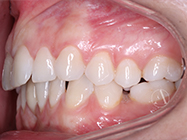 Before - Ali Orthodontics Dental