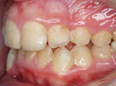 Before - Ali Orthodontics Dental