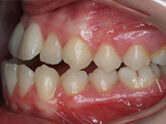 Before - Ali Orthodontics Dental