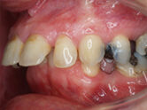 Before - Ali Orthodontics Dental