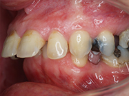 Before - Ali Orthodontics Dental