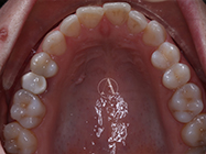 Before - Ali Orthodontics Dental