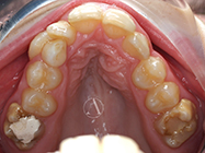 Before - Ali Orthodontics Dental